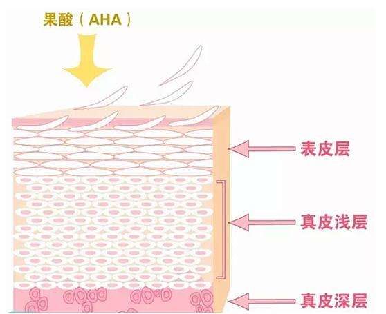 注射美白针副作用（打美白针有什么副作用？）-第8张图片