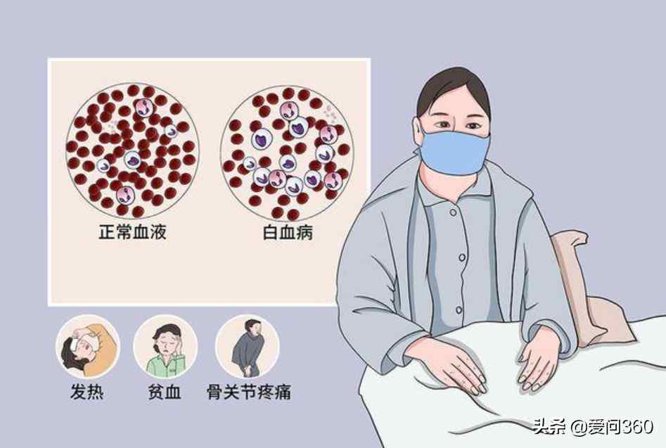 白血病怎么引起的（引发白血病的4个主要原因）-第3张图片