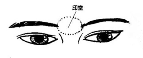 怎么看印堂发黑（印堂发黑有什么寓意）-第2张图片