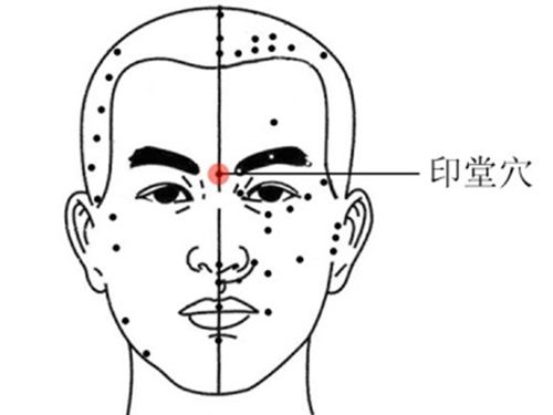 怎么看印堂发黑（印堂发黑有什么寓意）-第3张图片