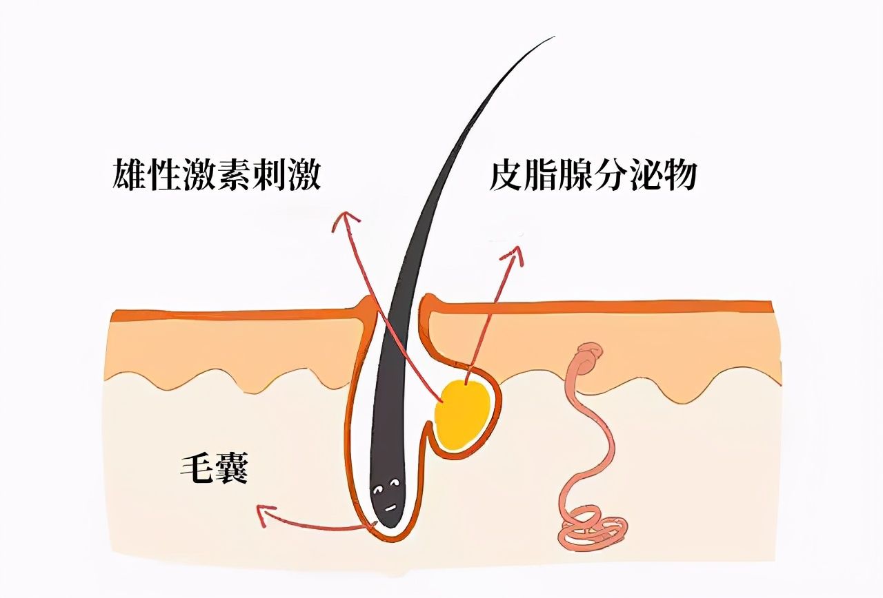 头发干枯（头发干枯毛躁是怎么回事？）-第4张图片