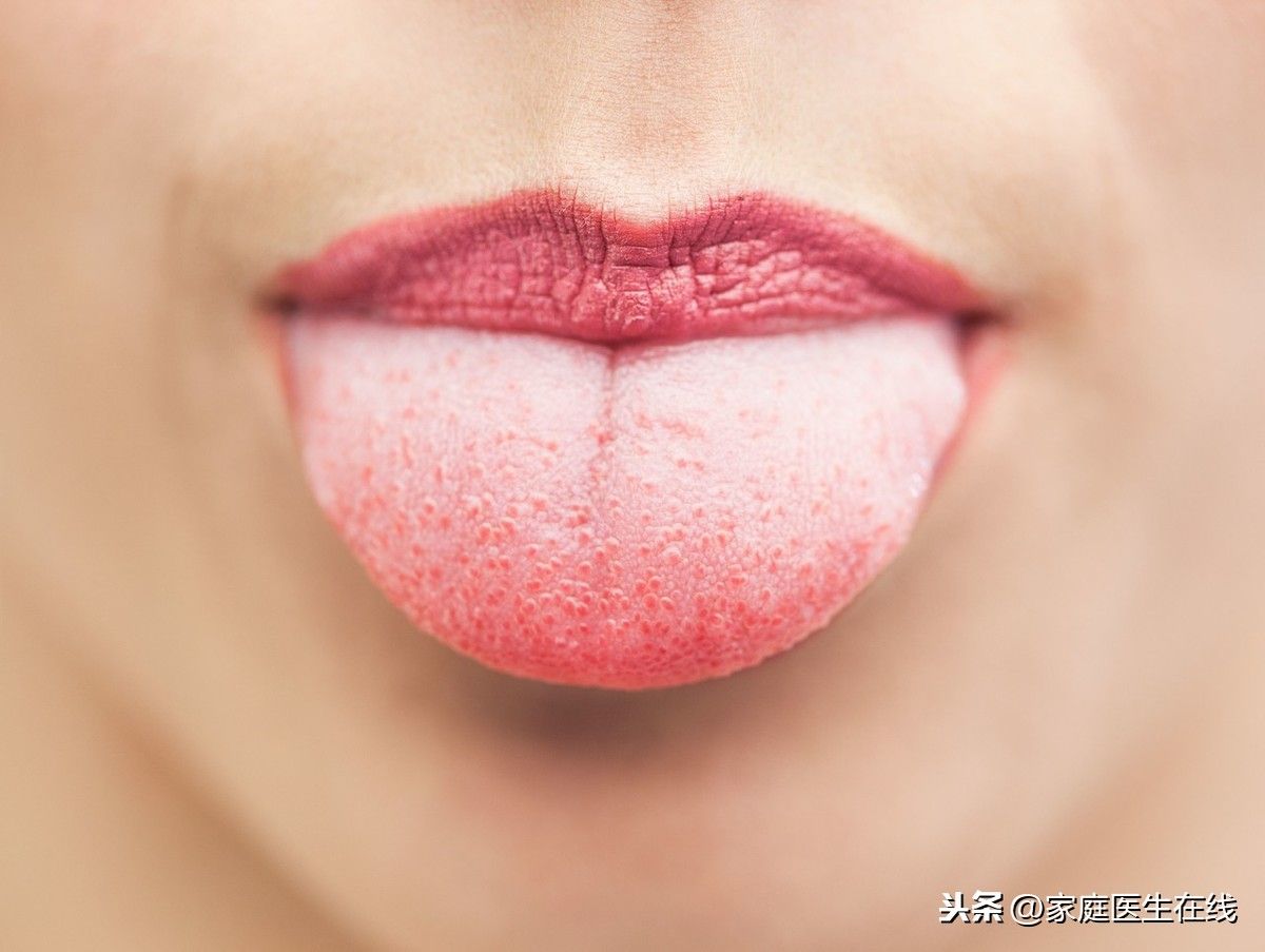 舌头发麻是什么原因？（舌头发麻是怎么回事？）-第1张图片