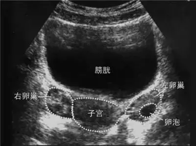 什么是排卵期（聊聊“排卵期”）-第3张图片