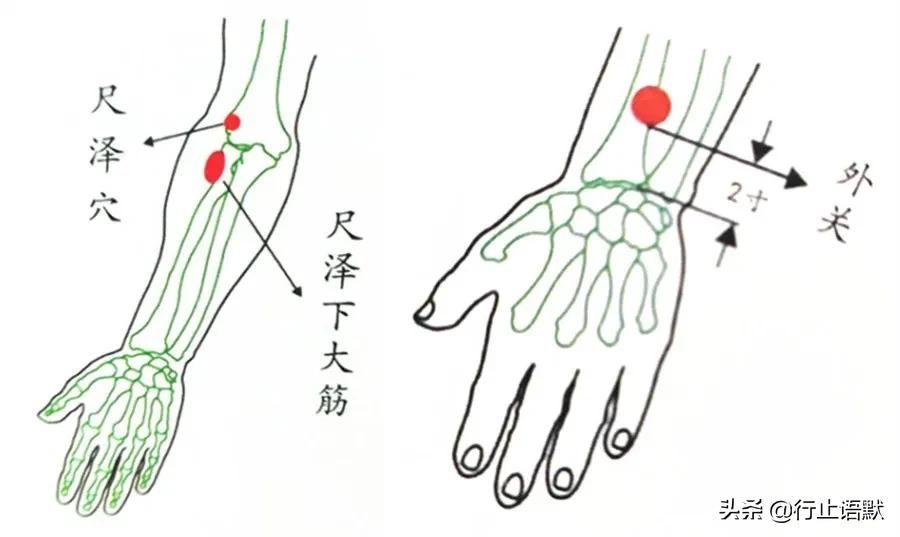 带状疱疹后遗症(带状疱疹后遗症的偏方 )-第1张图片