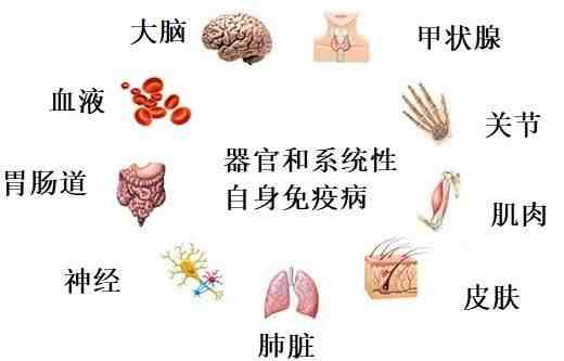 免疫系统疾病有哪些（免疫系统和常见免疫性疾病系列）-第4张图片