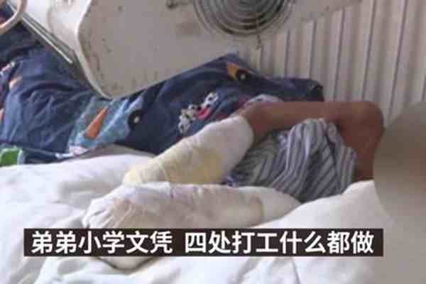 7岁男童遭烟头烫伤姑姑发声-广东7岁男童遭父亲烟头烫伤面临截肢-第1张图片
