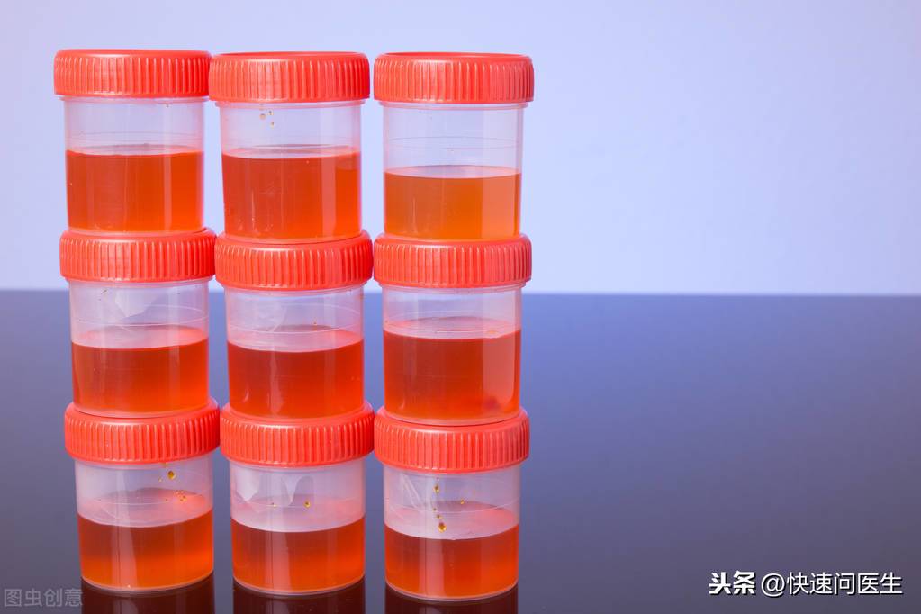 肾功能不好的表现(肾功能不好有哪些表现?)-第3张图片 肾功能不好的表现(肾功能不好有哪些表现?)-第3张图片