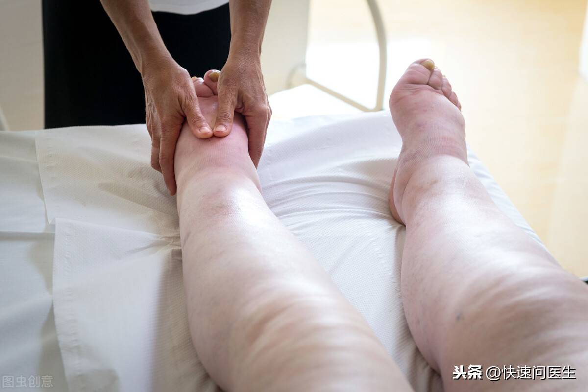 肾功能不好的表现(肾功能不好有哪些表现?)-第5张图片 肾功能不好的表现(肾功能不好有哪些表现?)-第5张图片