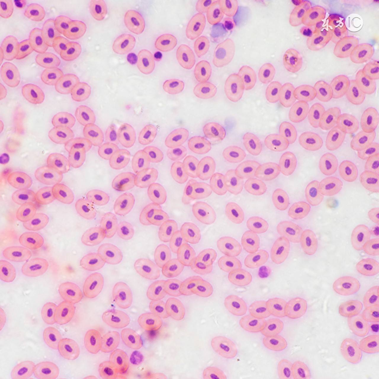 红细胞的作用（促红细胞生成素的5大作用）-第4张图片
