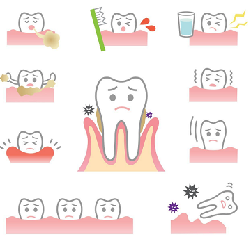 牙周炎能治好吗,牙周刮治的真实感受-第1张图片