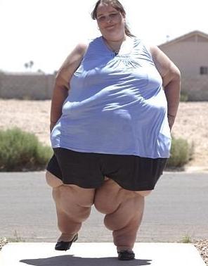 全世界最胖的人是多少斤（全球最胖长什么样的图片）-第15张图片