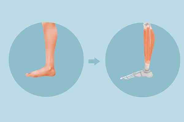 腿抽筋什么原因引起的（哪些原因会造成腿抽筋？）-第5张图片