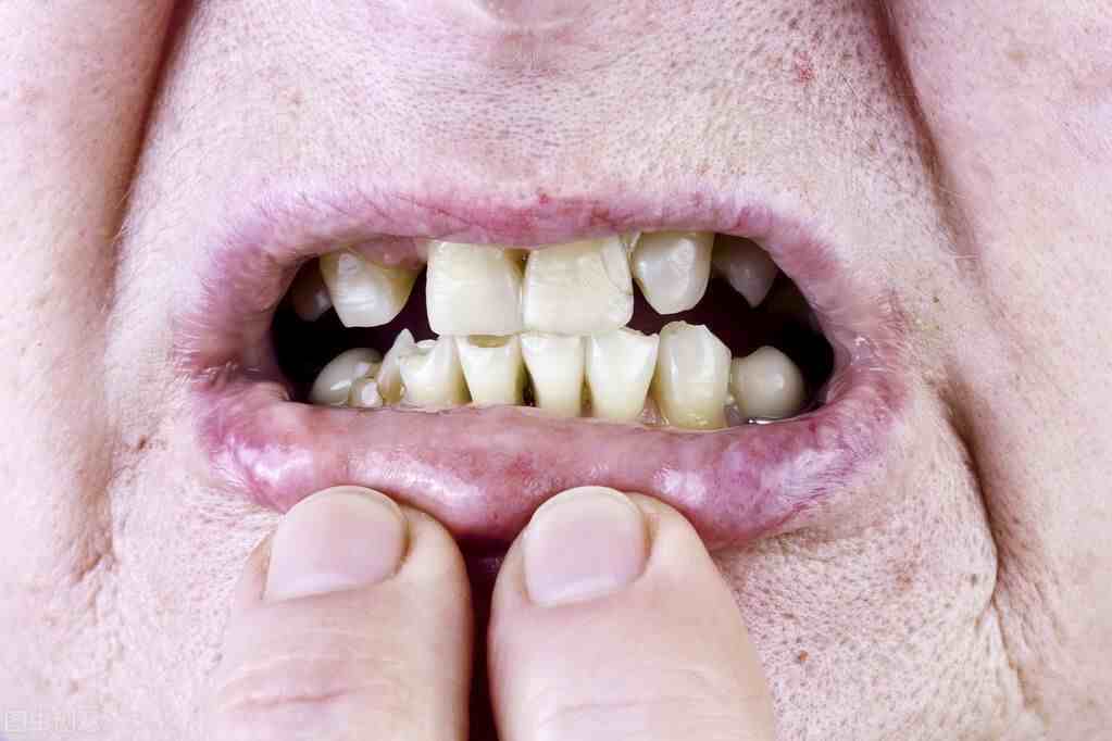 牙齿松动是什么原因（牙齿松动别轻视，当心是这4个原因在作怪）-第1张图片