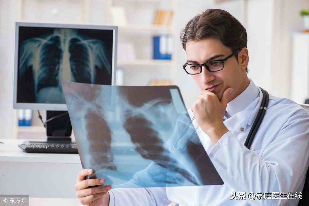 肺癌能治好吗（肺癌早期能治好吗？）-第3张图片