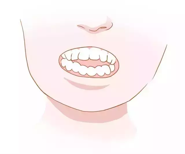 牙齿矫正图（牙齿矫正对颜值有多大影响）-第6张图片