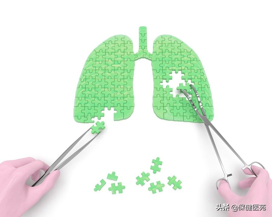 肺功能测定（重视肺功能检查，肺部疾病早知晓）-第3张图片
