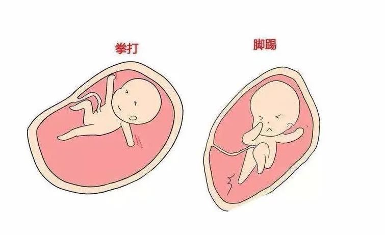 从胎动看男孩女孩（胎动与男孩女孩有关？）-第2张图片