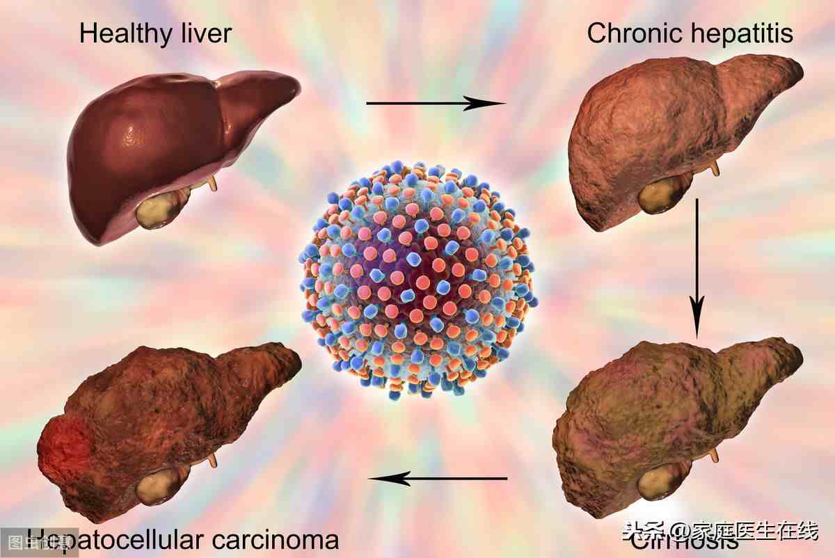 肝癌有哪些症状（肝癌的早期症状会有哪些）-第2张图片